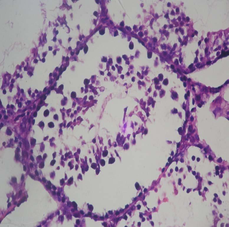 Gambar Mikroskopis Testis kelompok perlakuan 1 dengan menggunakan mirkroskop cahaya pembesaran 40x10 dan pewarnaan hematoksilin-eosin.