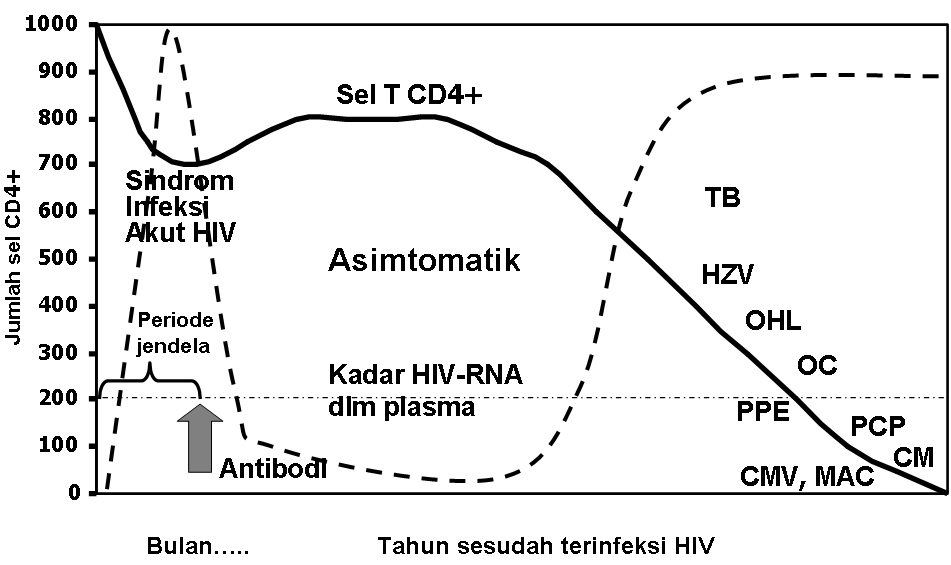 Gambar 3 : Perjalanan alamiah infeksi HIV/AIDS Infeksi Primer (sindrom retroviral akut) Setelah terjadi infeksi HIV mula-mula bereplikasi dalam kelenjar limfe regional.