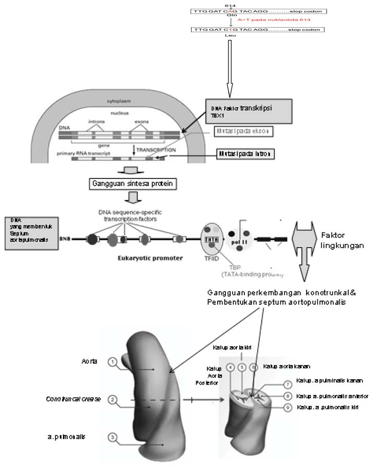 Gambar 2. Mutasi gen TBX1 dan interaksi dengan faktor lingkungan menyebabkan gangguan septasi konotrunkal dalam perdebatan.