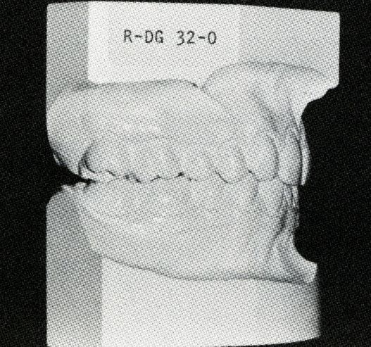 8 Untuk keperluan diagnosis ortodonti, model studi harus dipersiapkan dengan baik dan hasil cetakan harus akurat.