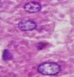Gambar 1. Gambaran histopatologi Organ Hati tikus (HE, 400x), A.