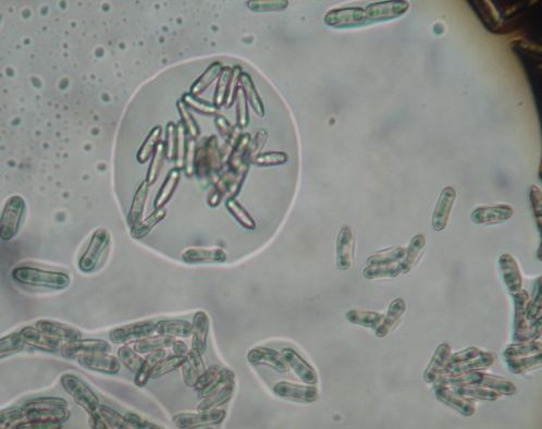 b a Gambar 3. Jamur M. anisopliae secara mikroskopik: (a). spora/konidia tunggal berbentuk bulat silinder; (b).
