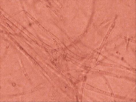 65 Gambar 4.6 merupakan gambar hasil pengamatan morfologi miselium jamur F.oxysporum yang diberi perlakuan dengan enzim kitinase dari bakteri P.pseudomallei.