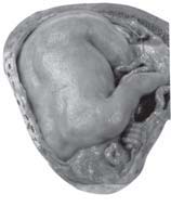 Perkembangan janin Anggota gerak embrio yang sudah terlihat Semua organorgan tubuh utama sudah terbentuk Rahim membesar untuk menyediakan tempat bagi bayi yang tumbuh Bayi yang terletak terbalik