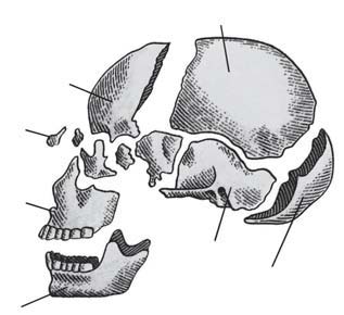 Tulang ubun-ubun atau (parietal) Tulang hidung Tulang dahi (frontal) Tulang rahang atas (maxilla) Tulang rahang bawah (mandibula) Tulang pelipis Tulang belakang (temporal) kepala (oksipital) Gambar 4.