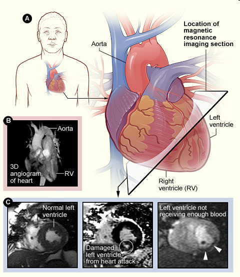 Cardiac Multi Sliced-CT Scan