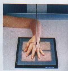PROYEKSI MANUS OBLIQUE Posisi Penderita sama Posisi Obyek : Lengan bawah fleksi diatas meja pemeriksaan Atur jari-jari tangan lurus dengan telapak tangan