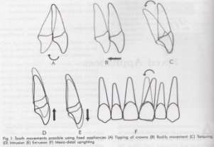 Berbagai perlekatan yang digunakan pada terapi alat cekat a.l. braket dan molar tube yang dilekatkan pada gigi menggunakan composite adhesive atau dapat juga dilekatkan pada metallic band yang selanjutnya disemenkan pada gigi.