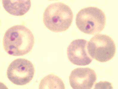 5 P. ovale (penyebab malaria ovale) (Anies 2006; Natadisastra & Ridad 2009). P. falciparum dan P. vivax merupakan jenis yang paling sering dijumpai, namun yang paling mematikan adalah jenis P.