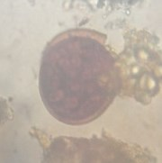Acaulospora sp 4