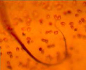 Daerah subkutan di seluruh tubuh A B C Gambar 2 Mikrofilaria Dirofilaria sp A. Mikrofilaria D. immitis (Ohio State University 2007) B.