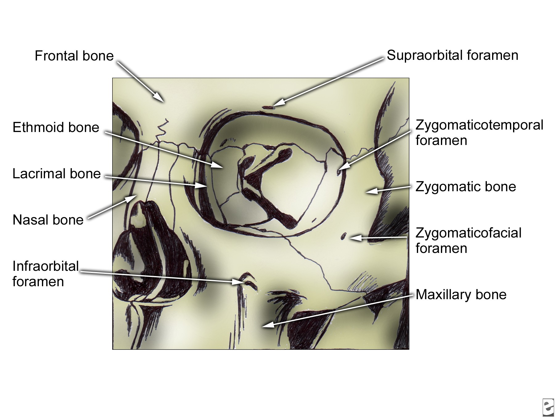 arah lateral. Tulang zigoma membentuk bagian lateral dinding inferior orbital, serta dinding lateral orbital.