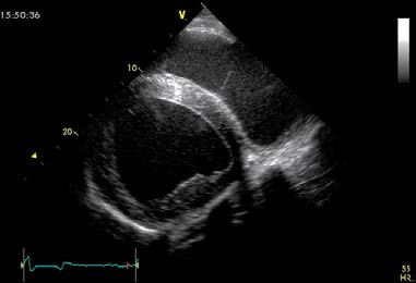 14 Ekhokardiografi Ekhokardiografi merupakan salah satu alat diagnostik non invasif yang paling berguna dalam pemeriksaan jantung kuda sejak diperkenalkan oleh Pipers dan Hamin pada akhir tahun