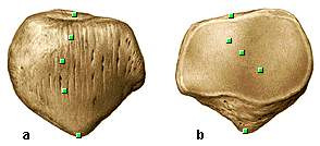 Merup os sesamoidea yang paling besar Bersendi dengan Femur tetapi tidak dengan Tibia Melekat pd Tuberositas Tibiae melalui kelanjutan tendon m.