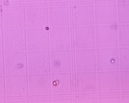 42 Kultur primer sel ginjal pada perlakuan pemberian vitamin E dapat diamati dengan menggunakan mikroskop inverted. Pengamatan viabilitas sel ginjal dengan cara pewarnaan tripan blue.