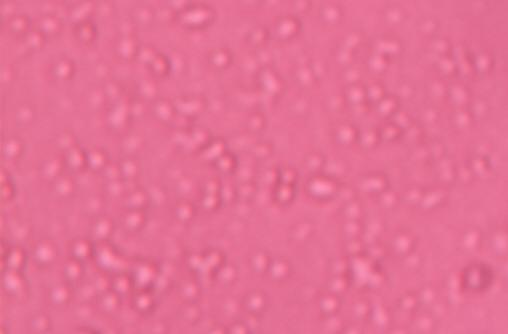 dengan menggunakan mikroskop inverted pada perbesaran 200x, seperti tampak pada gambar 4.1. Gambar 4.
