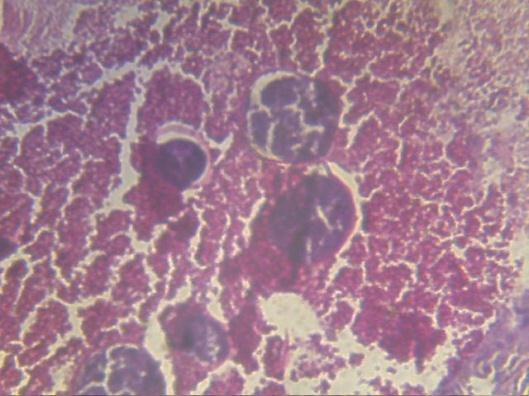 29 TKG I lobul mengandung spermatogonia sitoplasma tipis