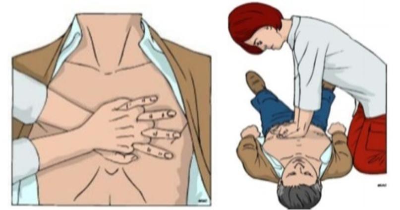 2) Resusitusi Jantung Paru (RJP) RJP terdiri dari penekanan dada dan bantuan napas dengan perbandingan 30:2 berarti 30 kali penekanan dada kemudian dilanjutkan dengan memberikan 2 kalibantuan napas.