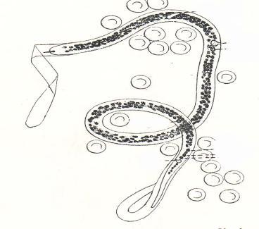 Gambar 2. Mikrofilaria W.bancrofti Dikutip dari Faust EC, Russel PF.,1964. W.bancrofti terutama ditemukan di daerah tropis dan subtropik.
