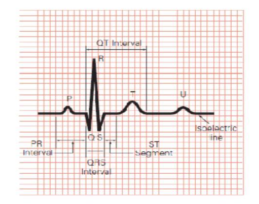 22 Gambar 2.11. Parameter pada isyarat EKG (Feldman, 1999). Elektrode berfungsi sebagai sensor yang mengubah besaran kimia dari energi ionis menjadi besaran elektris.