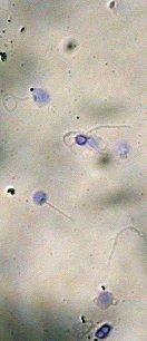 26 4.1.4 Morfologi Sperma Gambar 9 menunjukan bahwa sperma ikan gurame terdiri dari bagian kepala dan ekor.