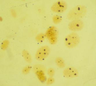 Vol. 15 No. 3 J.Ilmu Pert. Indonesia 189 transplantasi sel selanjutnya menggunakan larva ikan nila umur 2-4 hari. Tabel 1. Jumlah sel spermatogonia ikan gurame strain bastar dan blue saphire.
