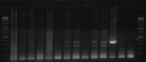 Deteksi kolonisasi sel donor dalam gonad ikan nila resipien diploid (nomor 1-5) dan hasil triploidisasi (nomor 6-11) dengan menggunakan metode PCR.