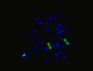 Pembuatan Kurva Kalibrasi Kromosom Translokasi Akibat Radiasi Gamma ISSN 1411 3481 (Yanti) a b c d Gambar 3.