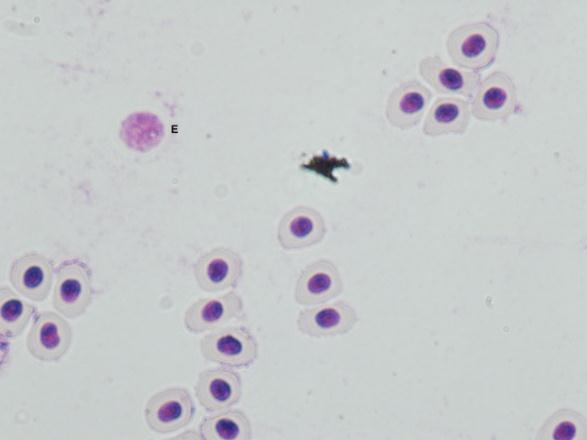 Keterangan gambar (a) : basofil; (b) : eosinofil; (c): trombosit; (d) : neutrofil. Komposisi leukosit pada ikan Bunglon Batik Jepara berbeda.