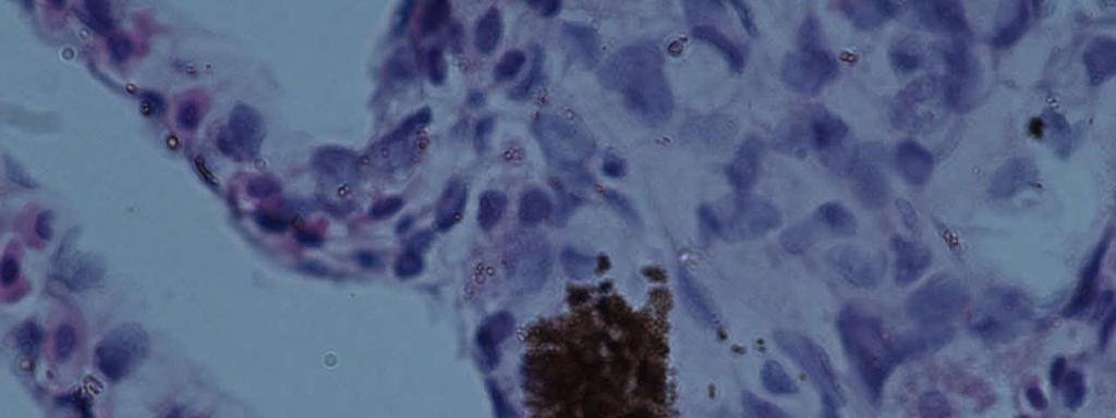35 Gambar 16 Perubahan lamella insang berupa hyperplasia sel epithel lamella sekunder (tanda asterik), sel radang (tanda kepala anak panah) dan MMC (tanda panah). Pewarnaan HE. Skala 10 µm.