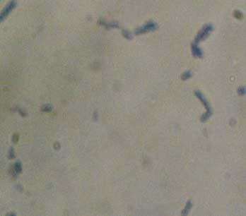 mesofil (Buckle, 1987) yaitu bakteri yang memiliki pertumbuhan 15 o C 45 o C dengan suhu optimum pertumbuhan 37 o C. 1A5 2B4 1B1 Gambar 7.