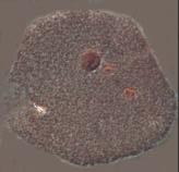 Sel-sel kumulus yang mengalami ekspansi pada saat pematangan terlepas akibat adanya enzim hyaluronidase yang dilepaskan oleh spermatozoa