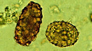 lumbricoides fertil, (b) Lumricoides
