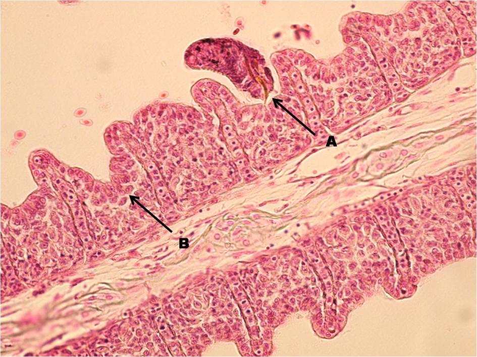 Histopatologis Insang Ikan Hias Air Laut yang Terinfestasi Gambar 5. Anchor Dactylogyrus sp. yang melekat pada lamela insang (A) dan hiperplasia sel-sel epitelia lamela insang (B) (H & E, 1000x.). Gambar 6.