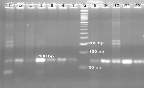 Amalia, Nindatama, Hayati &Handayani, Identifikasi Mutasi Gen Phosphate Buffer Saline (PBS) ph 7,4 sebanyak 2-3 kali dan supernatan dibuang selanjutnya ditambahkan Chelex 20% dalam ddh 2O ph dan 100