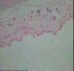 1 Infiltrasi Sel Radang Proses peradangan mencakup sel-sel radang dari pembuluh darah menuju