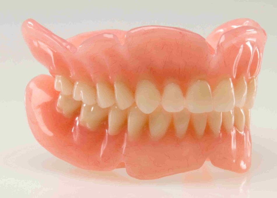 2.2 Gigitiruan akrilik 2.2.1 Definisi gigitiruan akrilik Resin akrilik merupakan bahan yang hingga saat ini masih digunakan di bidang kedokteran gigi.