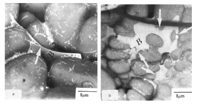 63 Gambar 2.41 Scanning Electron Micrograph morfologi fasa β platelets pada paduan Al- 7%Si-0,8%Fe (a) tanpa modifikasi Sr dan (b) dengan modifikasi 250 ppm. [62] Gambar 2.
