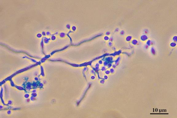 lisis dinding sel (anastomosis) sehingga protoplasma akan mengalir ke semua sel hifa. Miselium yang terbentuk akan makin banyak dan membentuk suatu koloni (Gandjar dkk, 2006). Gambar 6.
