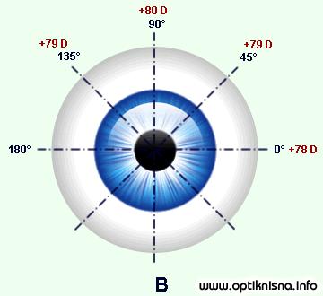 meredian 135. Astigmatisme jenis ini, jika mendapat koreksi lensa cylindris yang tepat, akan bisa menghasilkan tajam penglihatan normal.