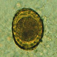 Telur infektif (telur yang mengandung larva) a b Gambar 4: (a) Telur (pembesaran 40 x 10) A. lumbricoides fertil dan (b) infertil (Prianto, J., dkk.