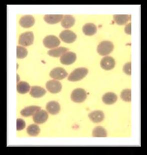 Bentuk dan warna parasit seperti pada Gambar 4.4 (b) yang dihitung sebagai jumlah parasit yang menginfeksi eritrosit setiap 1000 eritrosit dibawah mikroskop.