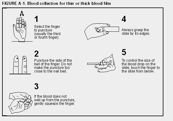 Sediaan darah tipis dan tebal 2.