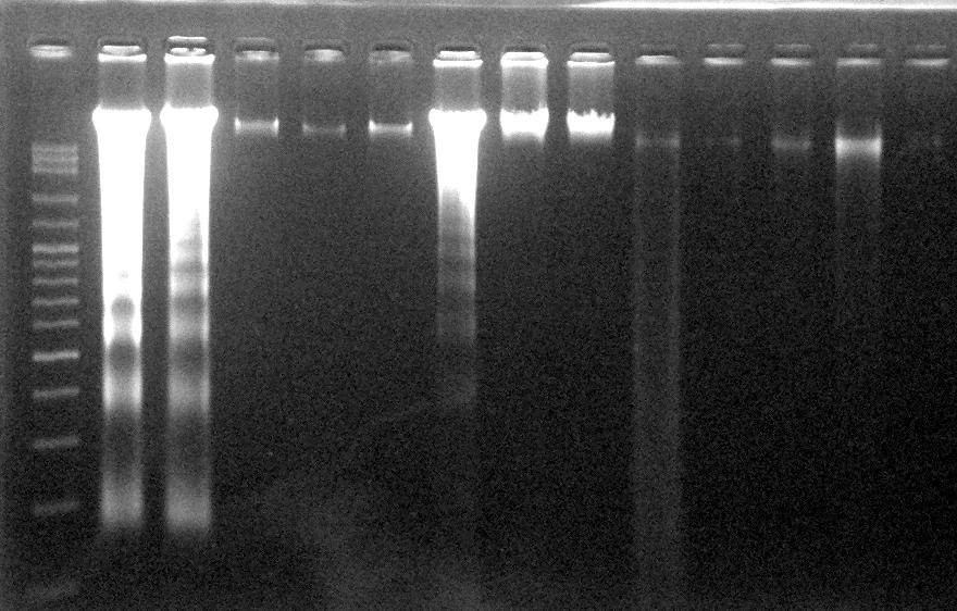 Pengujian kualitas DNA dengan menggunakan gel ditentukan oleh intensitas cahaya dari pita DNA pada media gel.
