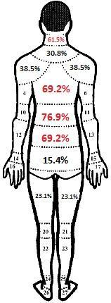 14 3.5 Gambaran Keluhan CTDs berdasarkan M asa Kerja 20% 0% 20% 20% 0% 40% 50% 15.4% 15.4% 15.4% 53.8% 15.4% 15.4% 53.8% 10% 10% 10% 10% 15.4% 15.4% 15.4% 38.5% 20% < 5 tahun 20% 38.5% 5 tahun 38.