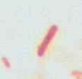 2: Bentuk sel bakteri secara  isolat