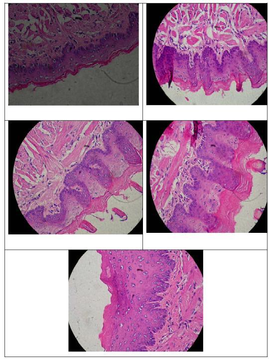 A C D B Gambaran Histopatologis Jaringan lidah tikus SD yang Diinduksi sel SPC-1 dan Pemberian 3 peringkat dosis Tablet hisap rimpang temulawak: A. Kontrol positif (beta karotene) B.