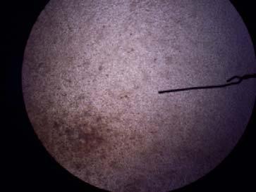 10), pemotretan menggunakan digital camera Kodak M853, sel tampak confluent A. kultur primer selsel pulpa gigi pada cawan petri setelah inkubasi ± 2 malam B.