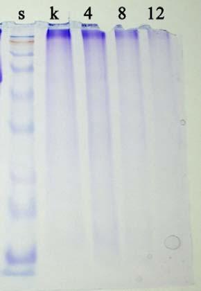 32 A B Gambar 5.4. Gambaran profil protein sel-sel pulpa gigi dengan pewarnaan Coomassie blue dan double staining oleh Silver Stain, pemotretan menggunakan digital camera Kodak M853.