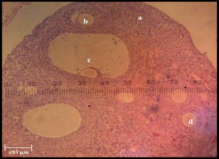 Gambar 9. Foto Mikroskopis Ovarium Tikus Putih Setelah Mendapat Perlakuan Pemberian Ekstrak Kacang Merah (HE, perbesaran 100x).